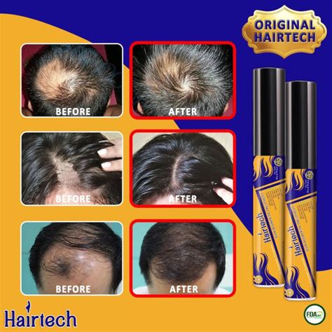 hairtech hair grower|HairTech Hair Grower The Holy Grail for Regaining Your